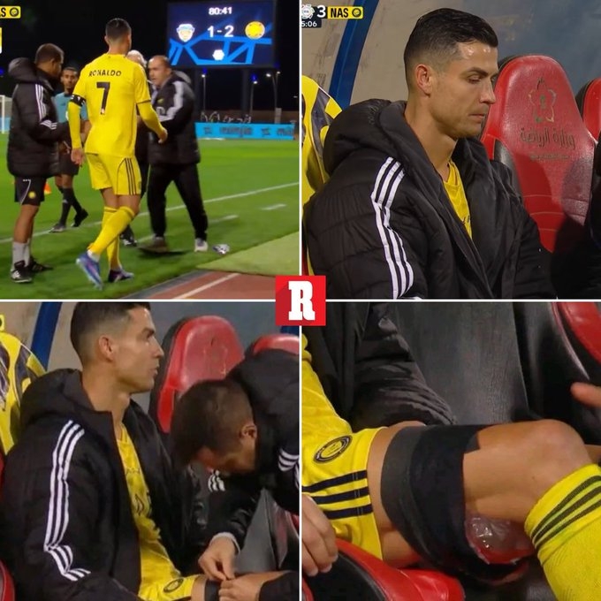 世界杯客户端升级说明-美媒：C罗可能是腿筋受伤，若情况属实或影响他参加3月国家队比赛